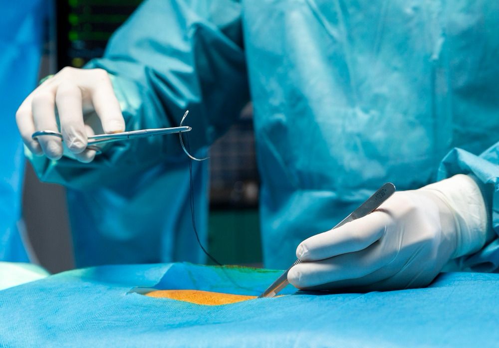 Nova resolução 731/2023 do Cofen garante que enfermeiros realizem sutura simples