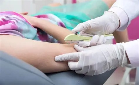 Enfermagem fortalece políticas de saúde da mulher no SUS com inserção do Implanon
