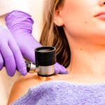 Cofen Autoriza Enfermeiros A Realizar Dermatoscopia Para Detecção Precoce Do Câncer De Pele