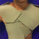 Estudo Mostra Que Curativo Mais Caro Pode Tornar Tratamento De Queimaduras Mais Eficiente E Econômico