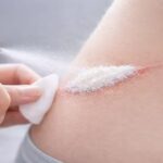 Pesquisadores Criam Spray Capaz De Estancar Hemorragias Em Segundos