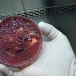 Superbactéria é Identificada Em 7 Pacientes E Leva Ao Fechamento De Uti