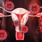 Austrália Se Aproxima De Eliminar O Câncer De Colo Do útero E Vira Referência Global