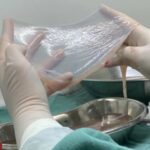 Sus Incorpora Membrana Amniótica E Amplia Tratamento De Feridas E Doenças Oculares